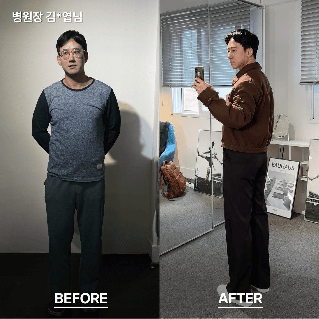 비포 애터 20