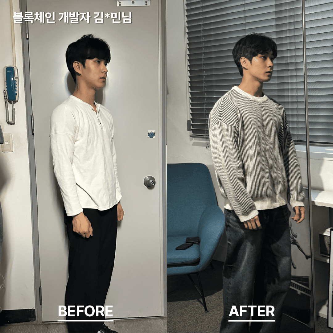 비포 애터 22